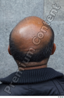 Street  601 bald hair head 0002.jpg